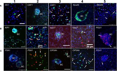 Frontiers Genome Wide Transcriptome Analysis Of Echinococcus